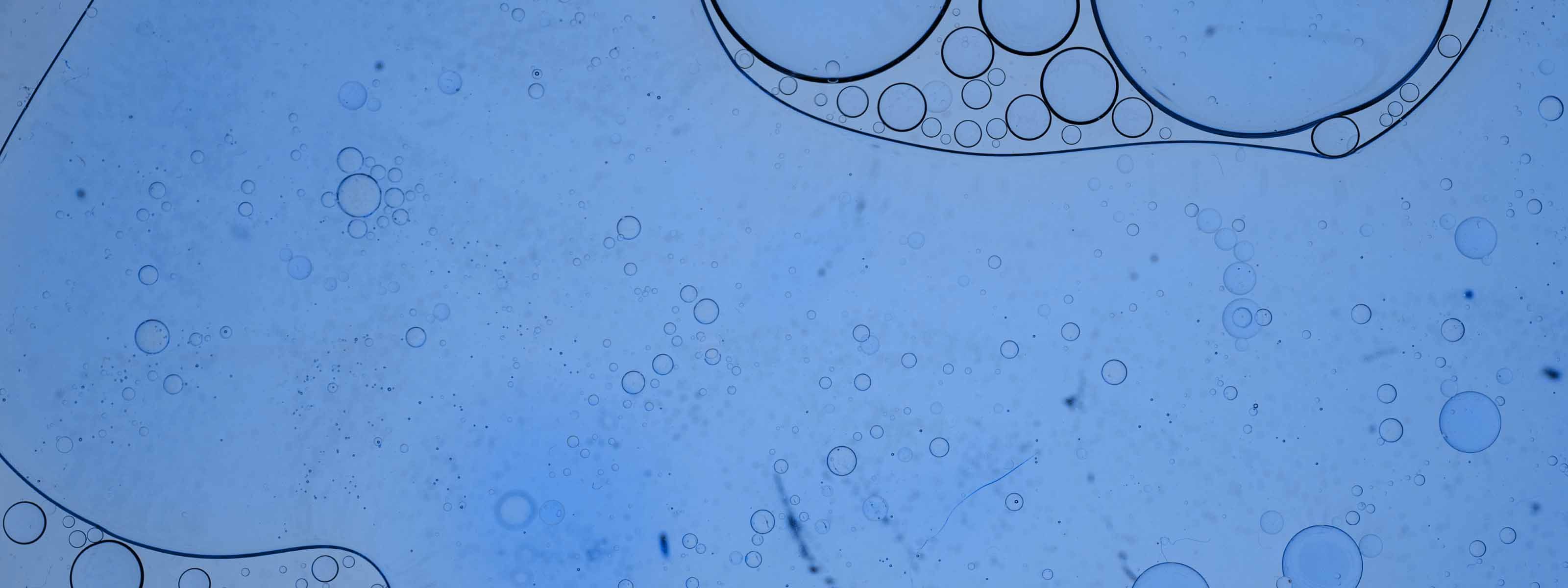 Blue microbe background with circular microbes overlaying image