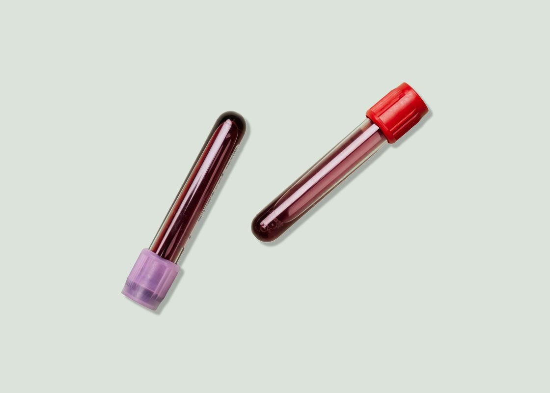 Two vials of blood with red and purple lids on a green surface