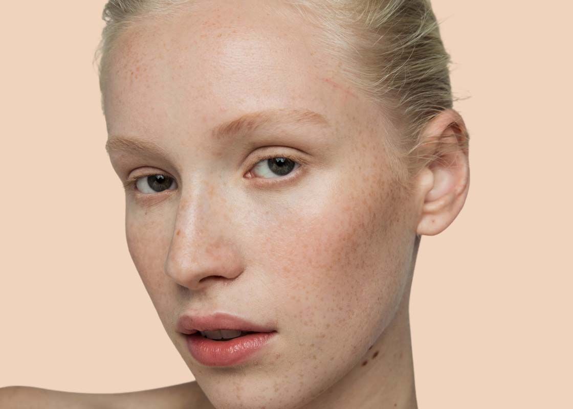 A close up of a fair skinned woman with freckles in front of a cream background