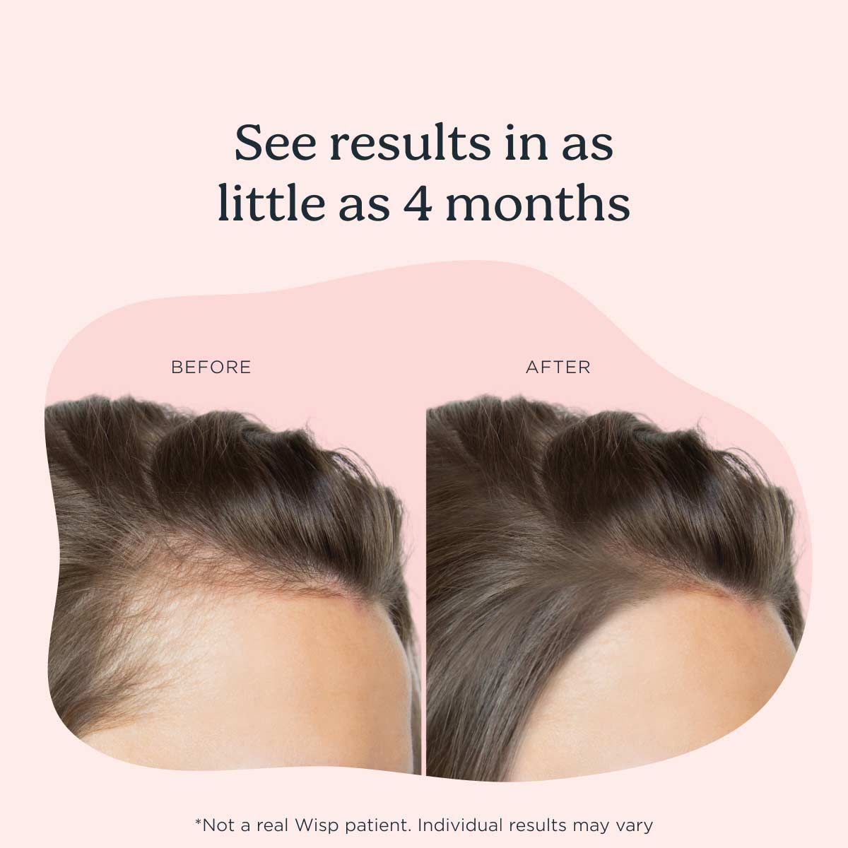 A before and after comparison of hair growth with a pink background
