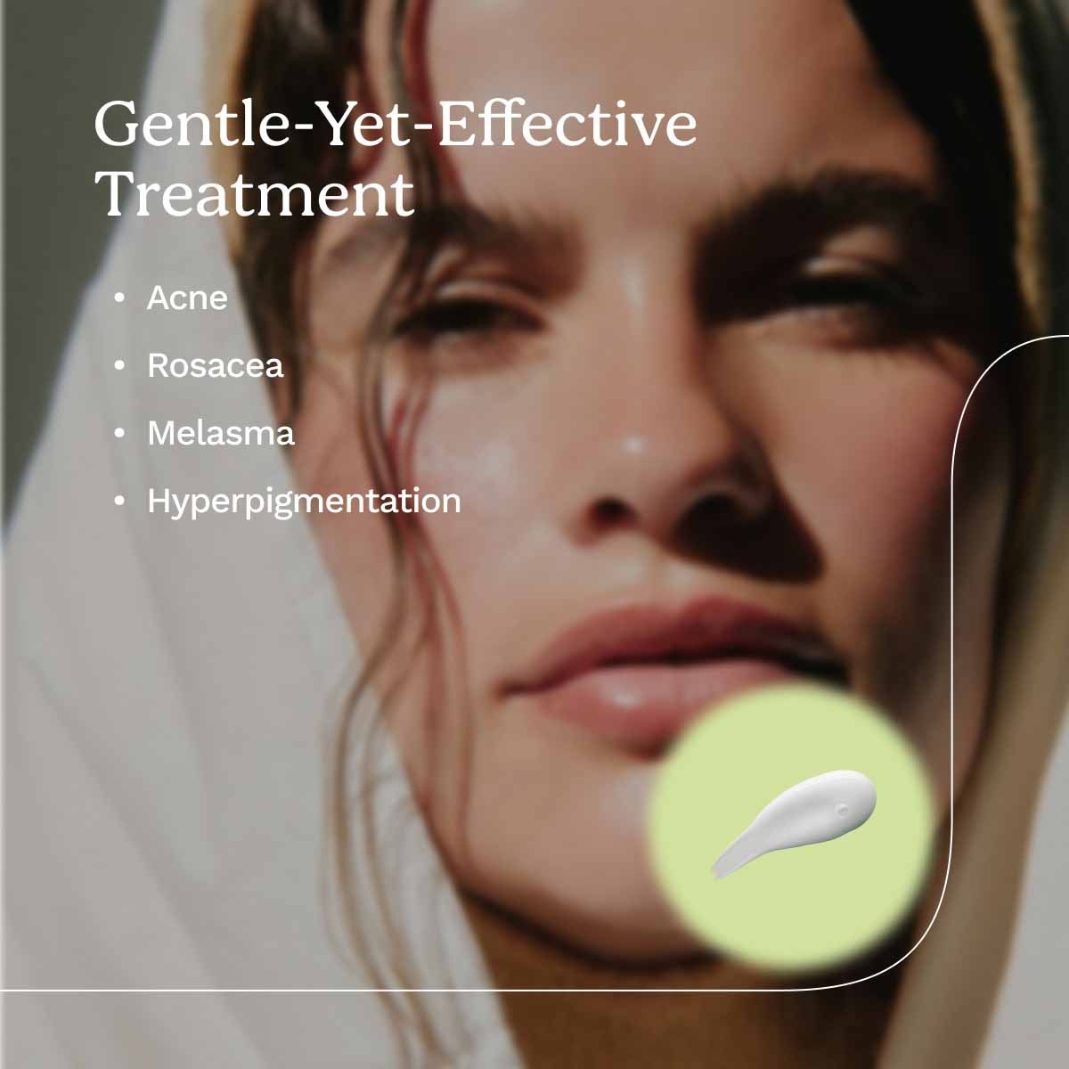 A woman with glowing skin with callouts about Azelaic Acid