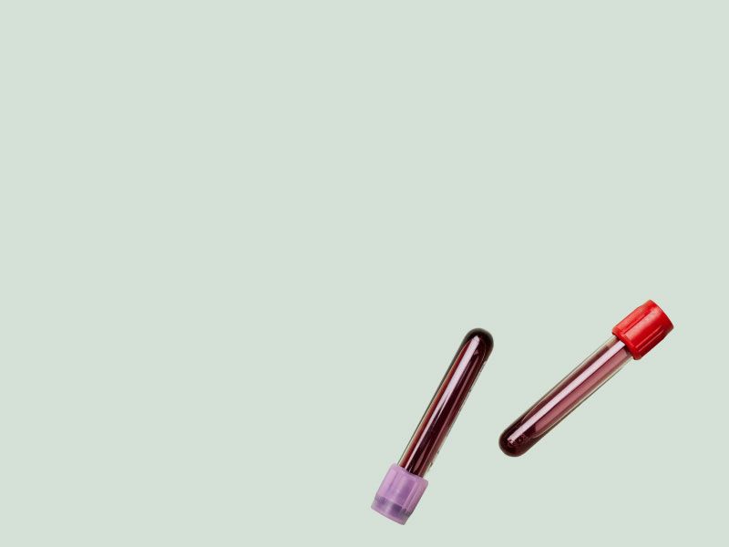 Two vials of blood with red and purple lids on a light green surface