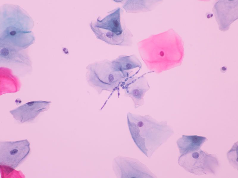 Microscopic view of vaginal bacteria